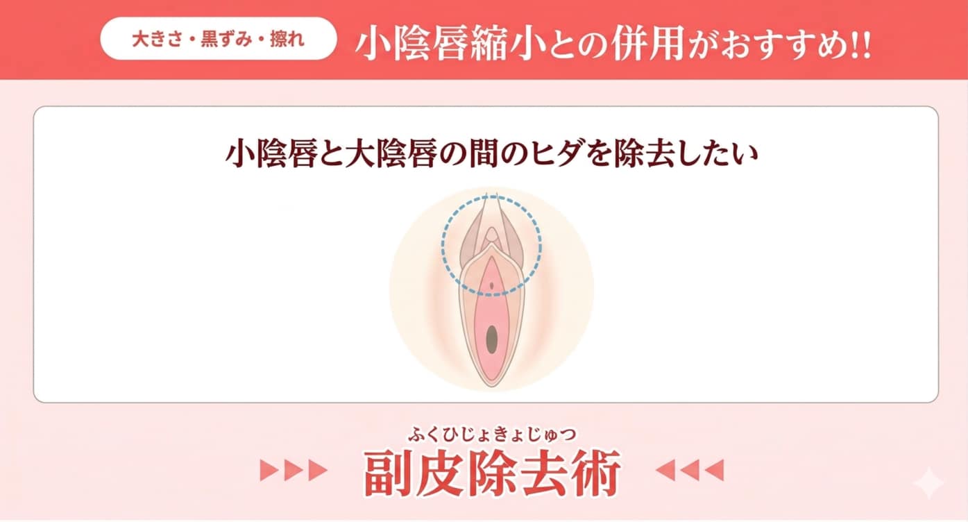 副皮除去術